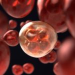 Ist Hautkrebs erblich genetisch bedingt?